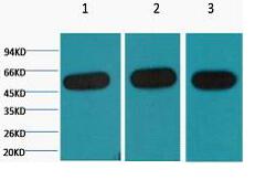 β-tubulin Monoclonal Antibody