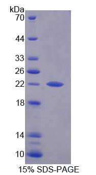 Recombinant Prefoldin Subunit 2 (PFDN2)