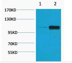 PEPC (Phospho Ser15) Polyclonal Antibody
