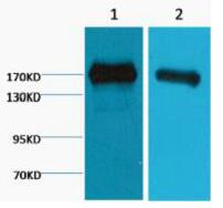 EGFR Monoclonal Antibody