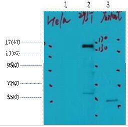 HER2 Monoclonal Antibody