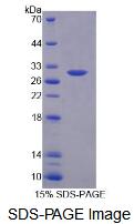 Recombinant Calcium Channel, Voltage Dependent, L-Type, Alpha 1S Subunit (CACNa1
