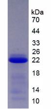 Recombinant Squamous Cell Carcinoma Antigen 2 (SCCA2)
