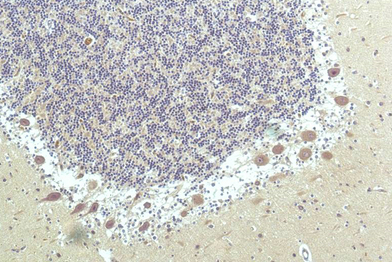 PPAR Delta Mouse Monoclonal Antibody(1D7)