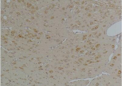 KChIP3 Polyclonal Antibody