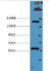 Western blot analysis of Hela, diluted at 1:2000.