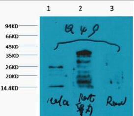 Histone H3 (Mono Methyl Lys79) Monoclonal Antibody(4C9)