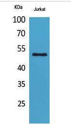 HNF-3α/β/γ (Acetyl Lys264/253/211) Polyclonal Antibody