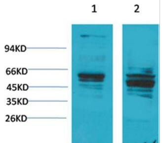 Bombesin Receptor 2 Polyclonal Antibody