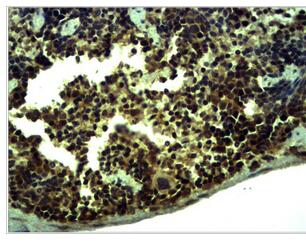 TLR1 Polyclonal Antibody