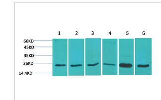 SOD2 Polyclonal Antibody