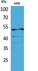 Cytokeratin 8 (Acetyl Lys483) Polyclonal Antibody