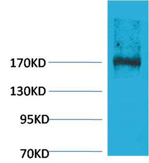 EPG5 Polyclonal Antibody