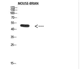2F-1 (Acetyl-Lys120) Polyclonal Antibody
