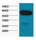 β I tubulin Monoclonal Antibody