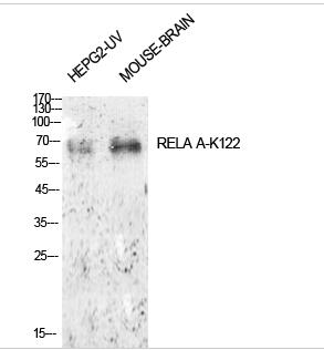 NFκB-p65 (Acetyl Lys122) Polyclonal Antibody