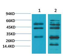 TGFβ1 Polyclonal Antibody