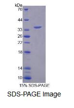 Recombinant Replication Factor C2 (RFC2)