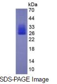 Eukaryotic Interleukin 6 (IL6)