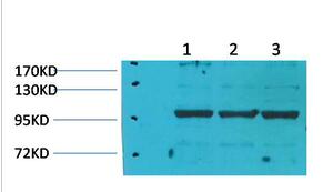 IGFN1 Polyclonal Antibody