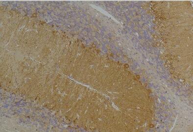 KCNN3 (SK3) Polyclonal Antibody