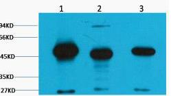 FH Fumarase Monoclonal Antibody