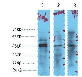 NSE Monoclonal Antibody
