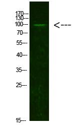 AR(Acetyl-K631) Polyclonal Antibody