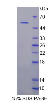 Recombinant Klotho (KL)