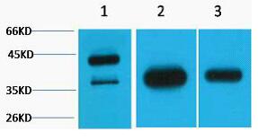 GAP43 Polyclonal Antibody