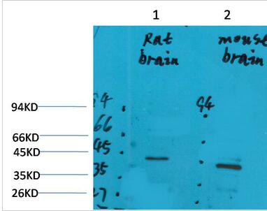 GALR2 Polyclonal Antibody