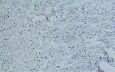 CD10 Monoclonal Antibody