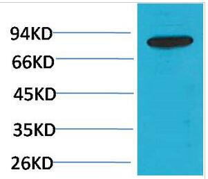 PI 3-Kinase p85β Polyclonal Antibody