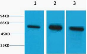 β Tubulin Polyclonal Antibody