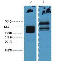 CK8 Monoclonal Antibody