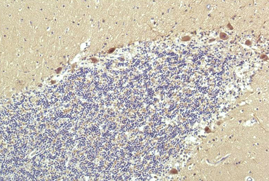 PPAR Delta Mouse Monoclonal Antibody(2F9)