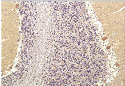 SGK1 Mouse Monoclonal Antibody(4D12)