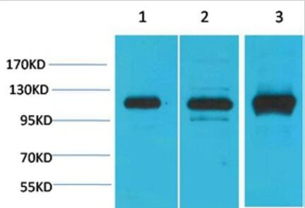 CaVα2δ2 Polyclonal Antibody