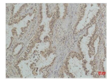 P53 (Mono Methyl Lys370) Monoclonal Antibody