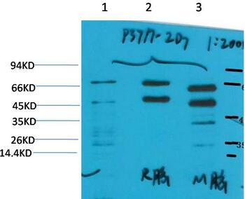 Phosphoserine Monoclonal Antibody