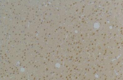 KVβ1 Polyclonal Antibody