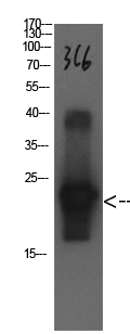 Cystatin C Mouse Monoclonal Antibody(3C6)