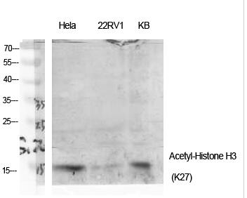 Histone H3 (Acetyl Lys27) Polyclonal Antibody