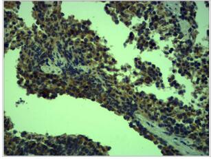 TLR4 Polyclonal Antibody