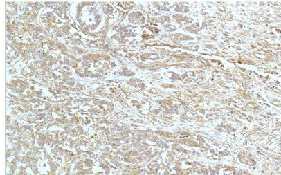 a-actinin Monoclonal Antibody(4A12)