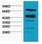 Rubisco Polyclonal Antibody