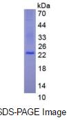 Eukaryotic Factor Related Apoptosis (FAS)