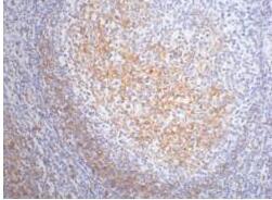 CD23 Monoclonal Antibody