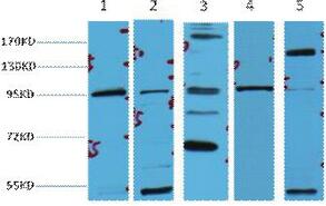 β-Catenin Monoclonal Antibody