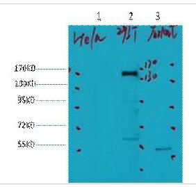 HER2 Monoclonal Antibody